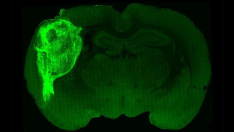 Крысе пересадили человеческий мозг — что из этого вышло?