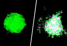 Фото - Онкологи обнаружили, что проникновение бактерий в опухоль может вызвать метастазирование